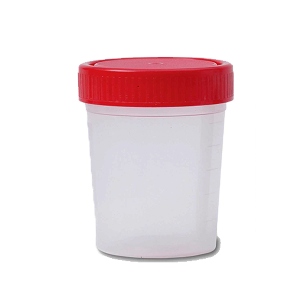 FRASCO MUESTRA DE ORINA 60 ML